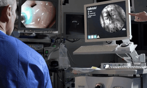 Cellvizio at Florence Healthcare International
