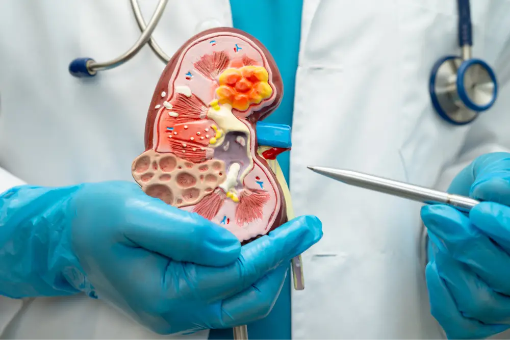 Kidney Transplant