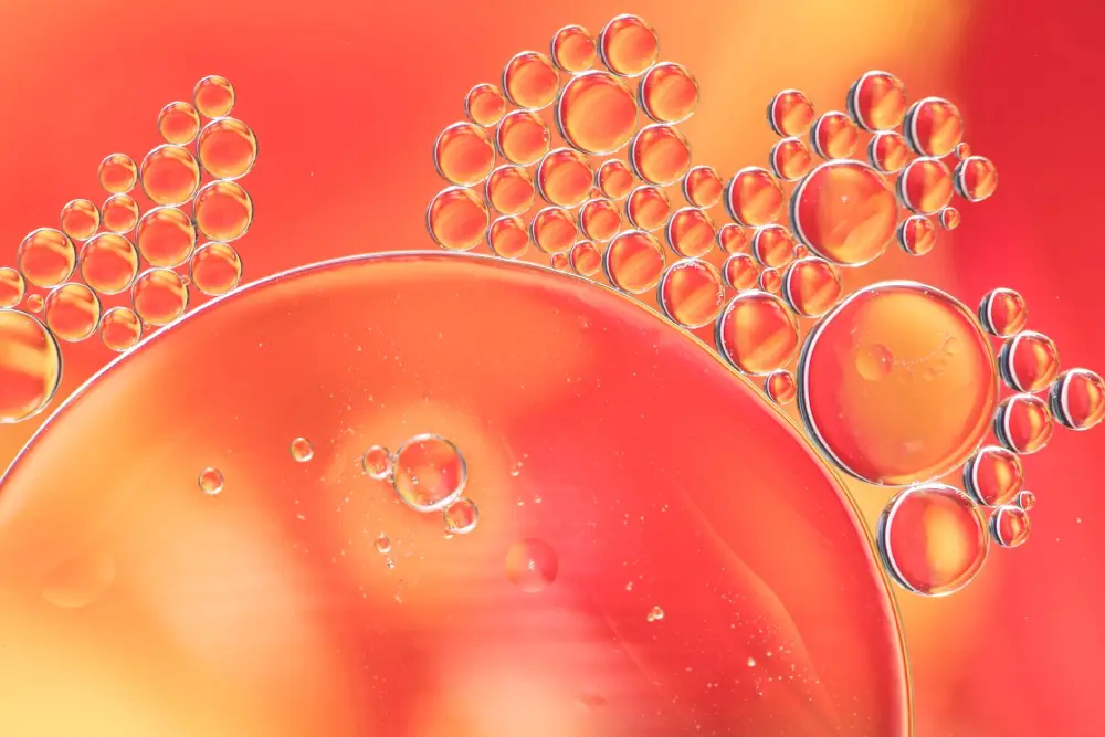 How does cystic fibrosis affect amino acids in the body