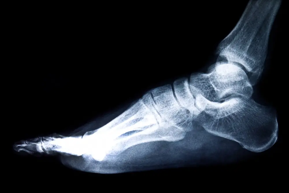 is heel pain a sign of cancer