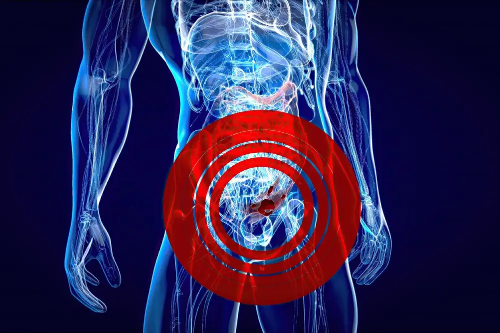 Robotic Hernia Surgery