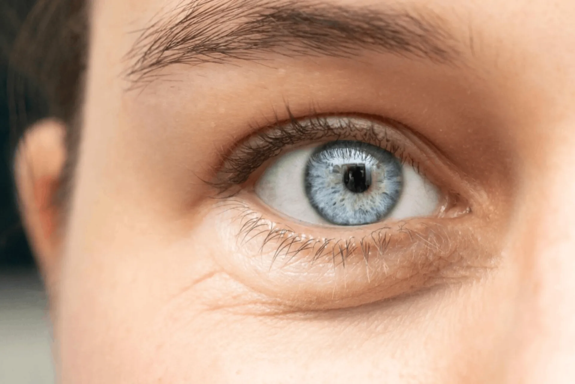 What is a cornea transplant?