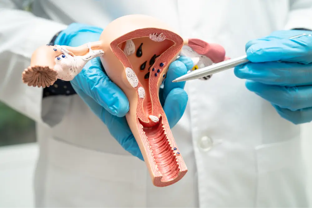 What Is Bladder Cancer? Symptoms, Treatment, and Prevention