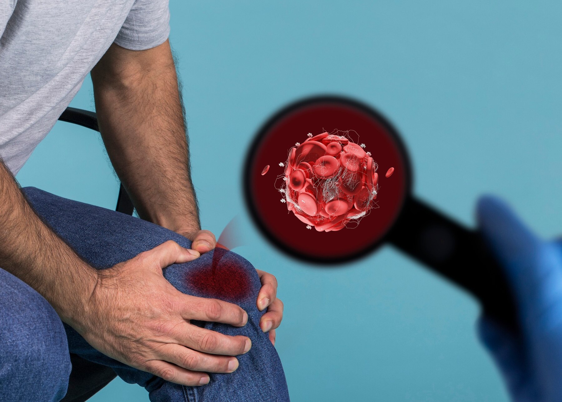 What You Need to Know About Bone Marrow Transplants
